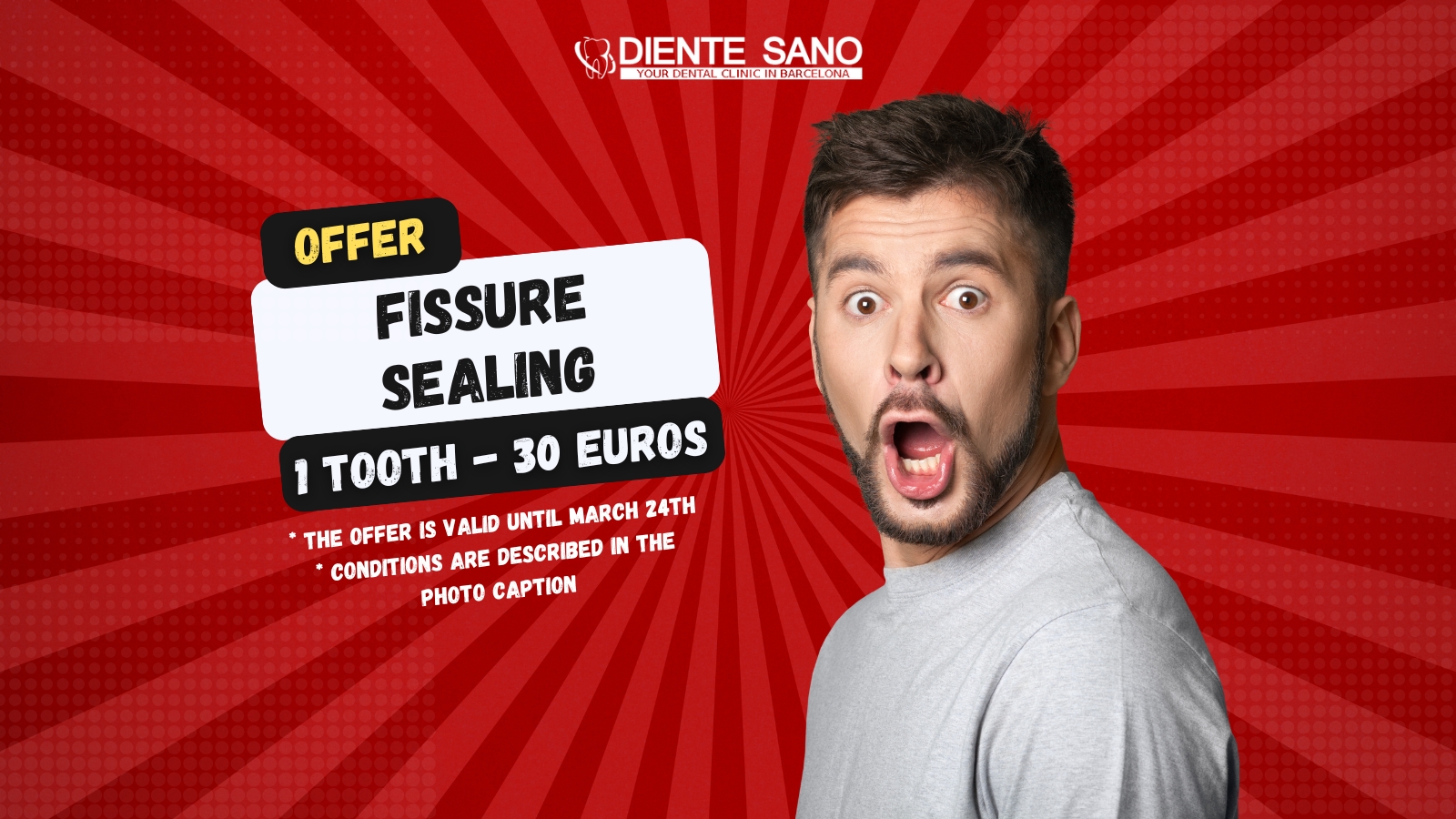Special offer at Diente Sano Dental Clinic in Barcelona!: Taking care of your smile starts with prevention. We invite you to take advantage of our unique offer for sealing fissures in a single tooth for just 30 euros!