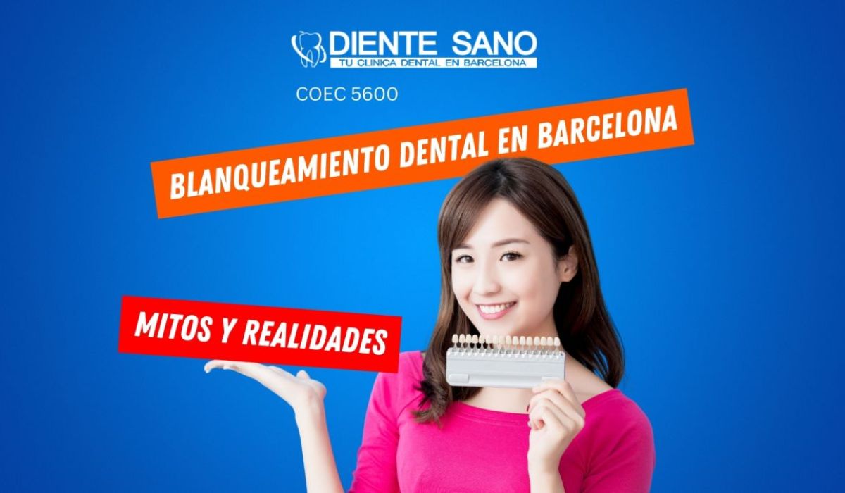 Blanqueamiento dental en Barcelona: mitos y realidades