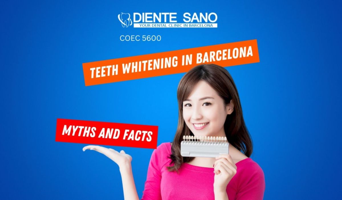 Teeth Whitening in Barcelona: Myths and Facts