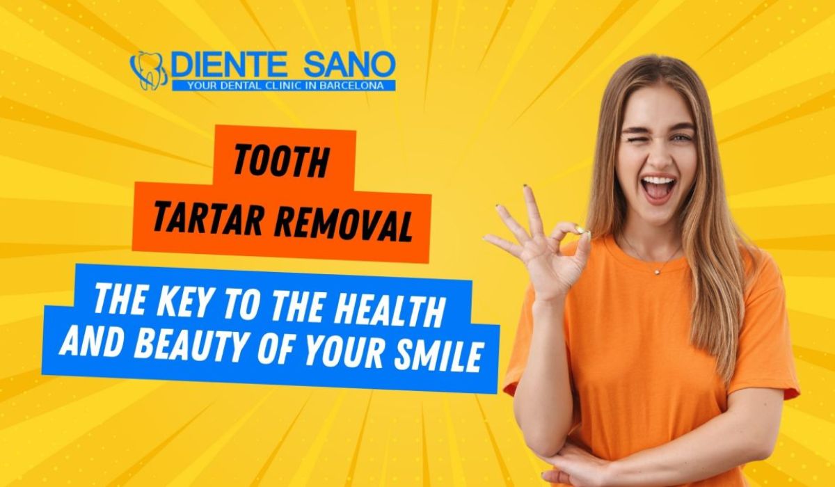 Tooth Tartar Removal: The Key to the Health and Beauty of Your Smile