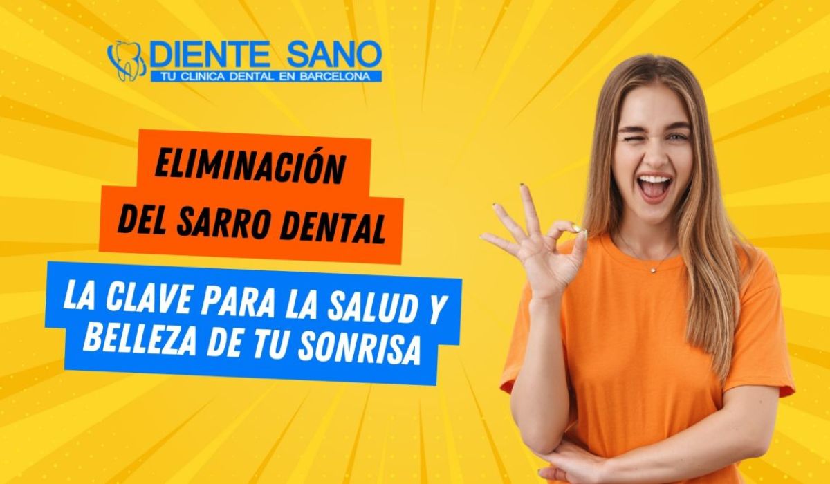 Eliminación del sarro dental: La clave para la salud y belleza de tu sonrisa
