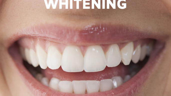 Why whiten your teeth?
