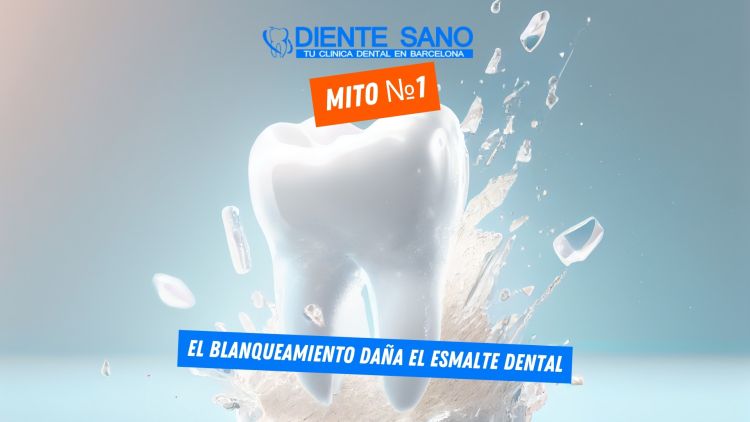 Blanqueamiento dental en Barcelona: mitos y realidades