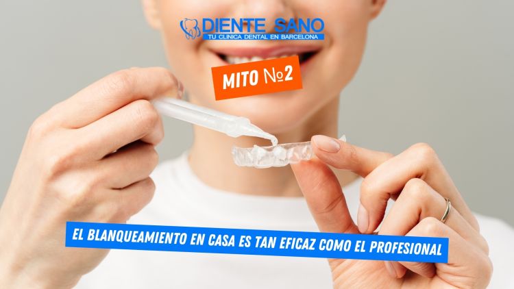 Blanqueamiento dental en Barcelona: mitos y realidades