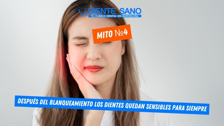 Blanqueamiento dental en Barcelona: mitos y realidades