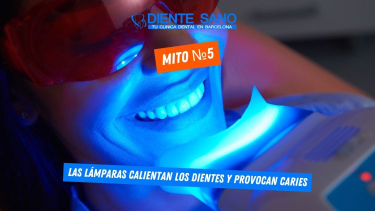 Blanqueamiento dental en Barcelona: mitos y realidades