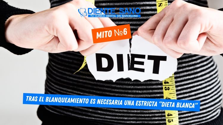 Blanqueamiento dental en Barcelona: mitos y realidades