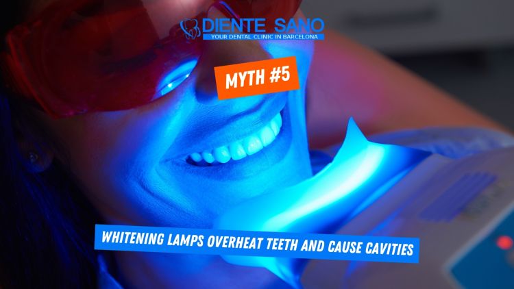 Teeth Whitening in Barcelona: Myths and Facts
