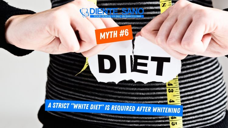 Teeth Whitening in Barcelona: Myths and Facts
