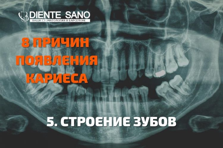 8 причин появления кариеса, советы стоматолога! Строение зубов также влияет на появление и развитие кариеса.